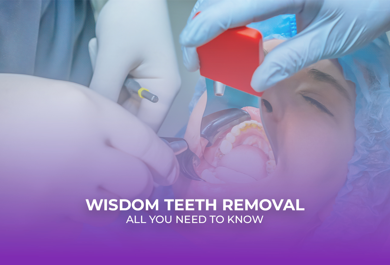 WISDOM TEETH REMOVAL – ALL YOU NEED TO KNOW